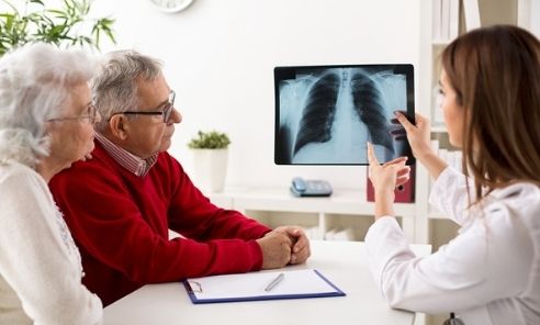 Factores de riesgo del cáncer de pulmón: ¿cómo evitarlos?