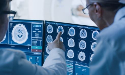 ¿Qué tan rápido crece un tumor maligno y cómo detectarlo?