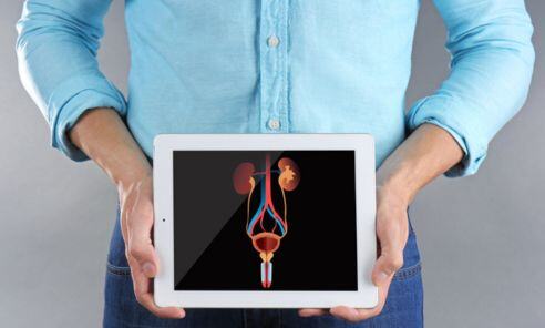 ¿Cuándo se debe realizar el examen de detección de cáncer de próstata?