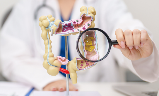 Cáncer de colon: síntomas, factores de riesgo, prevención y tratamientos