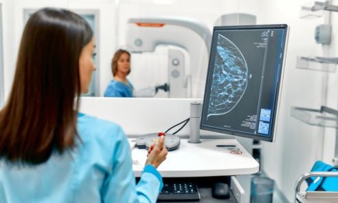 Guía para interpretar los resultados de una mastografía de cáncer de mama