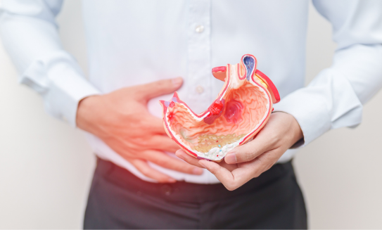 Cáncer de estómago: síntomas, causas, diagnóstico y tratamientos